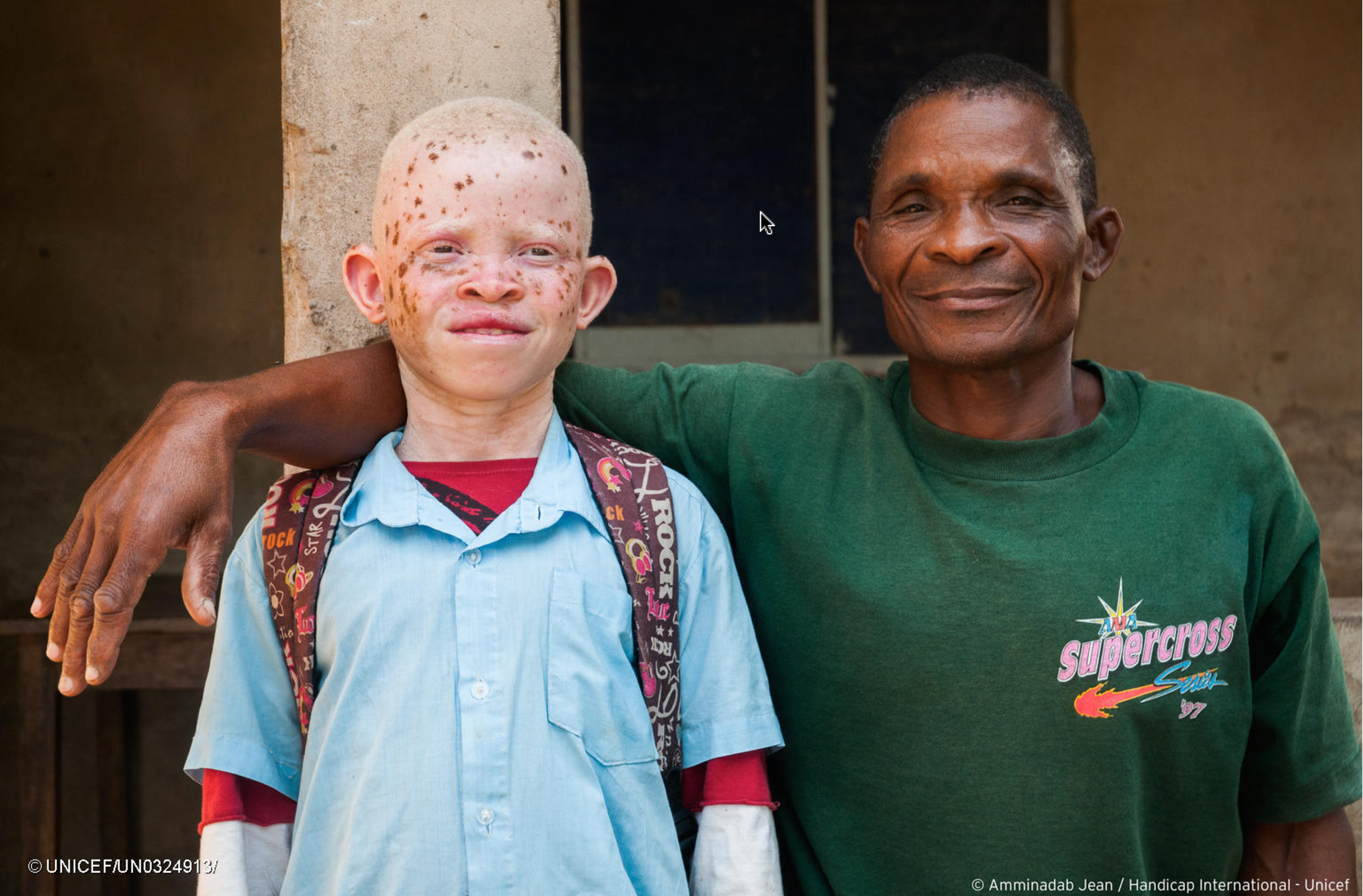 What do efforts to care for children with albinism tell us about disability inclusive care reform?